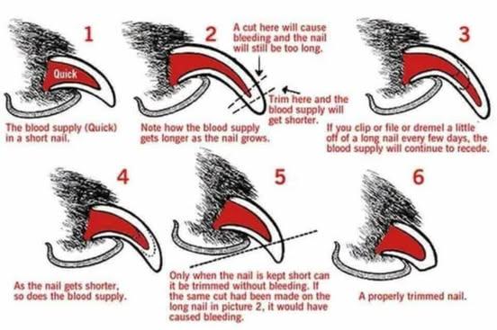 Nail Clipping Advice Diagram